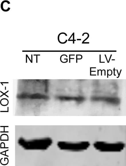 Detection of Human LOX-1/OLR1 by Western Blot