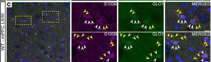Detection of S100B by Immunohistochemistry