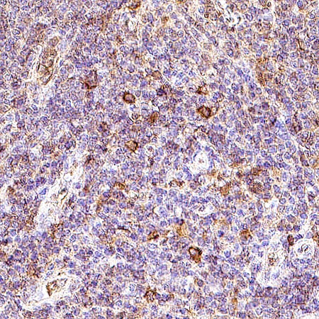 Human NKp46/NCR1 Antibody AF1850: R&D Systems