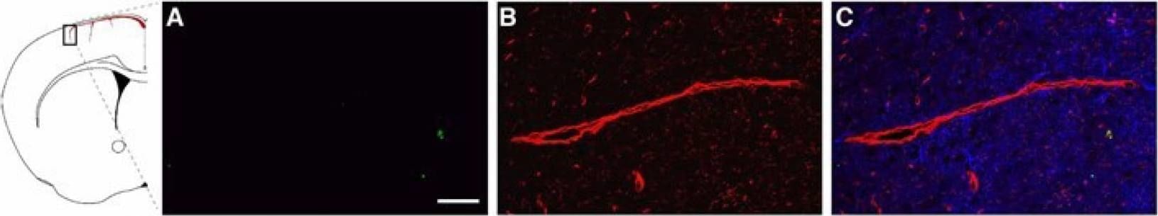 Detection of Mouse Lipocalin-2/NGAL by Immunocytochemistry/Immunofluorescence