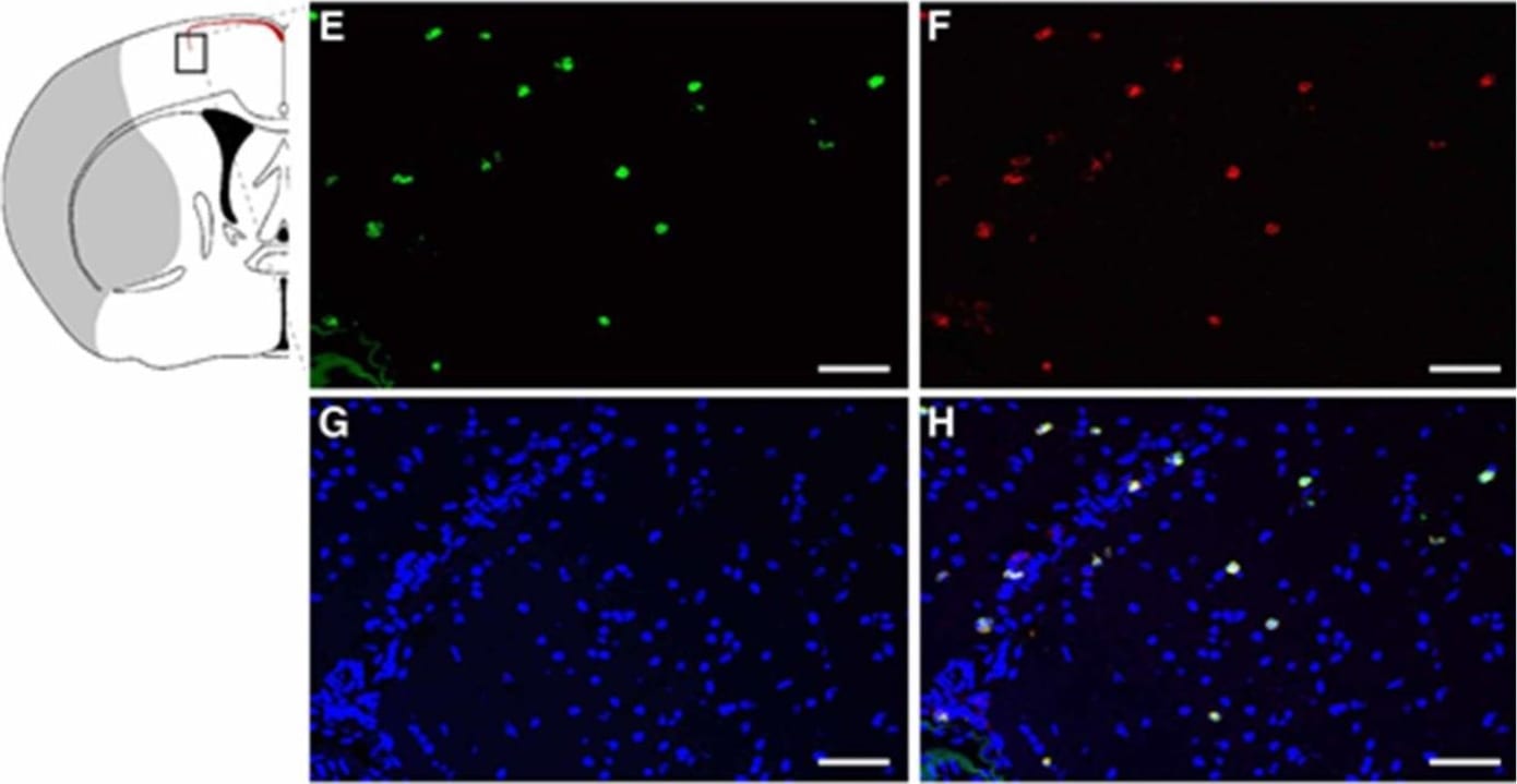 Detection of Mouse Lipocalin-2/NGAL by Immunocytochemistry/Immunofluorescence
