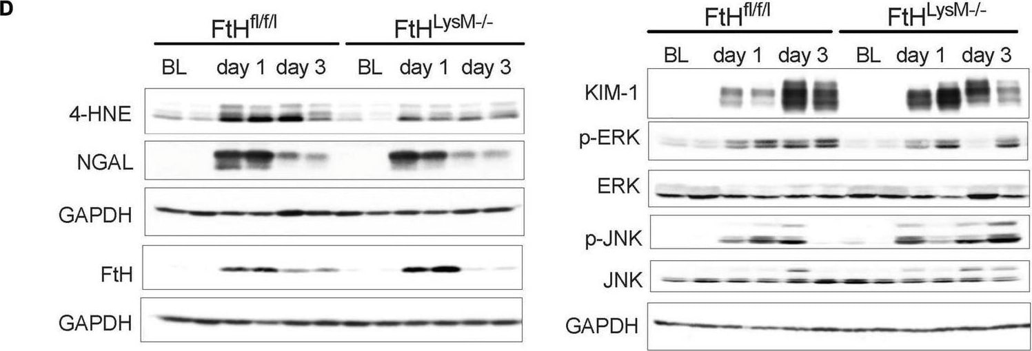 Detection of Lipocalin-2/NGAL by Western Blot