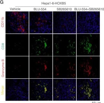 Detection of Granzyme B by Immunocytochemistry/ Immunofluorescence