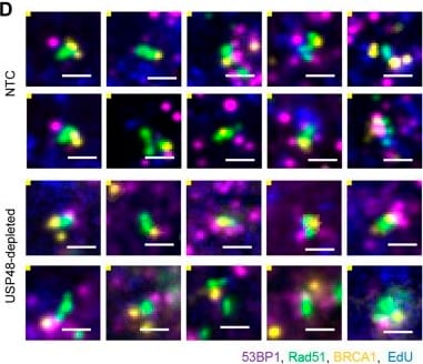 Detection of 53BP1 by Immunocytochemistry/ Immunofluorescence