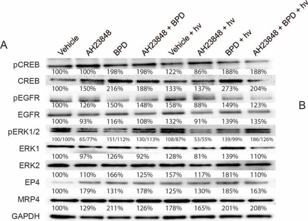 Detection of ERK1 by Western Blot