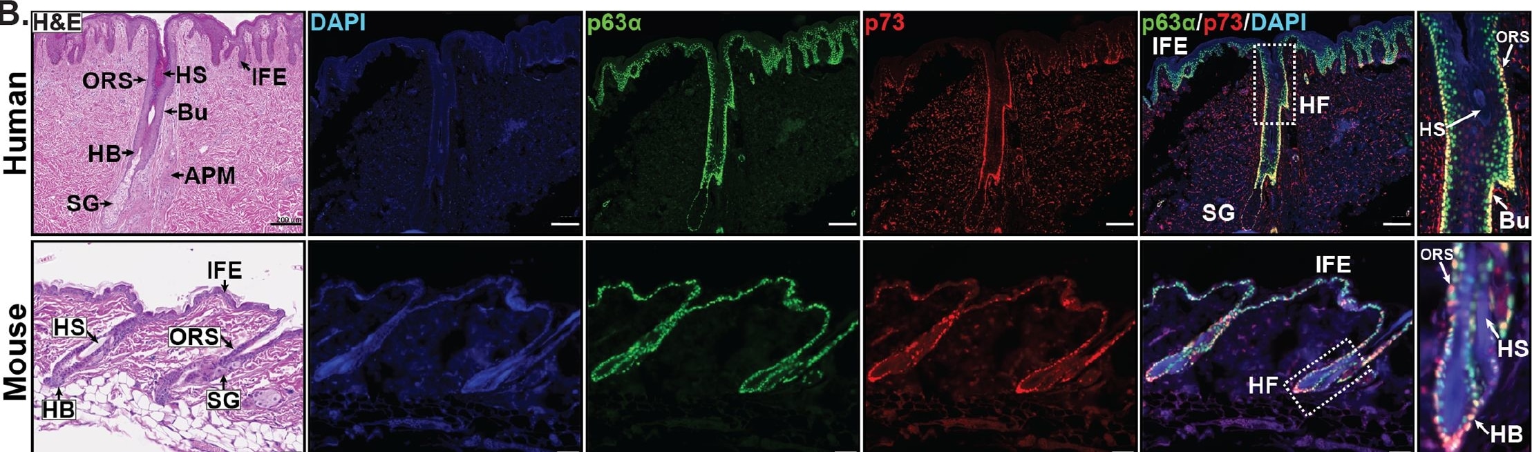 Detection of Mouse p63/TP73L by Immunocytochemistry/Immunofluorescence