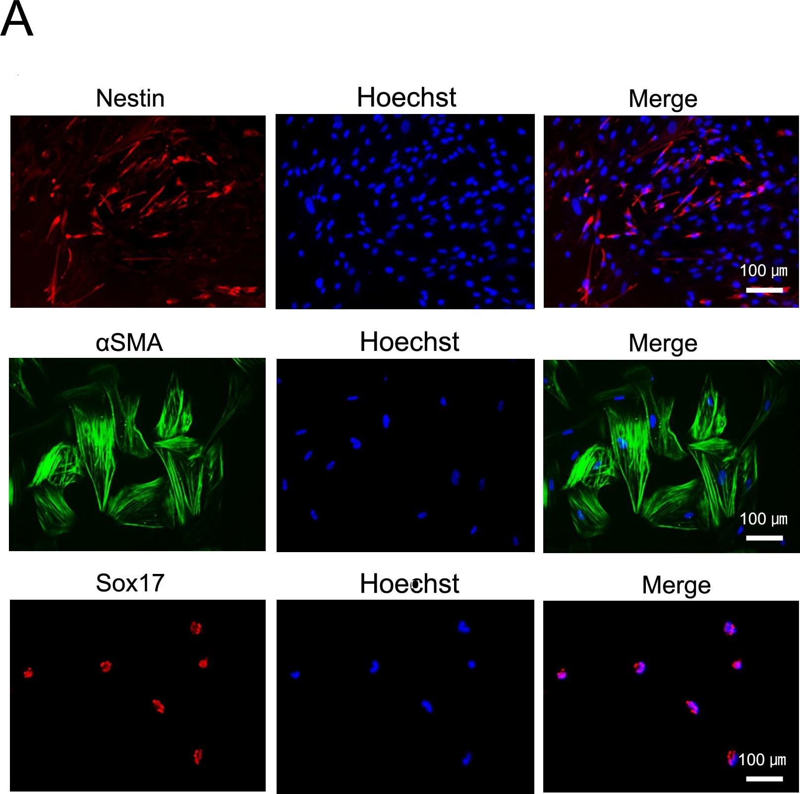 Detection of Human SOX17 by Immunocytochemistry/Immunofluorescence.