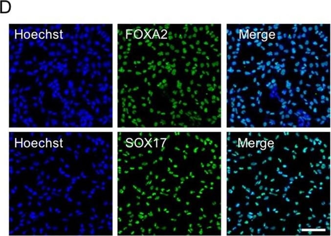 Detection of Human SOX17 by Immunocytochemistry/Immunofluorescence.