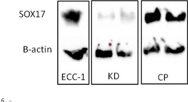 Detection of Human Human SOX17 Antibody by Western Blot
