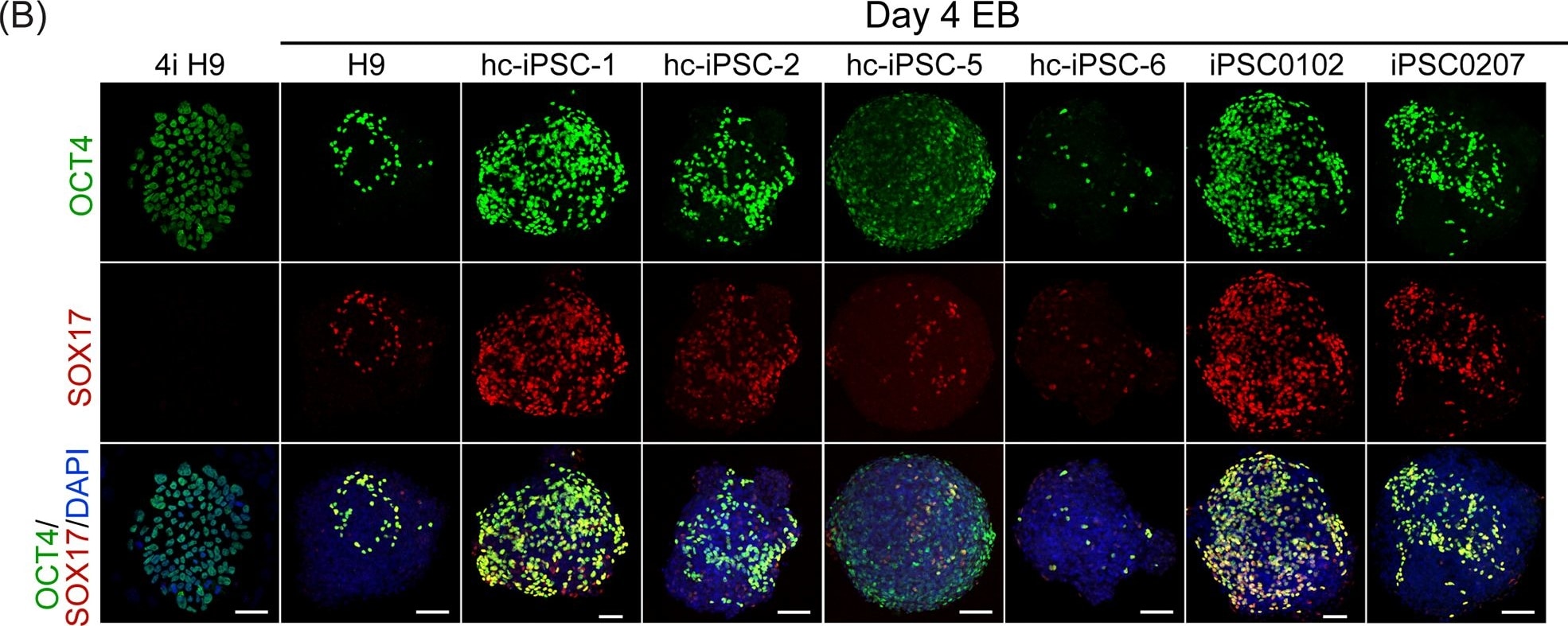 Detection of Human SOX17 by Immunocytochemistry/Immunofluorescence