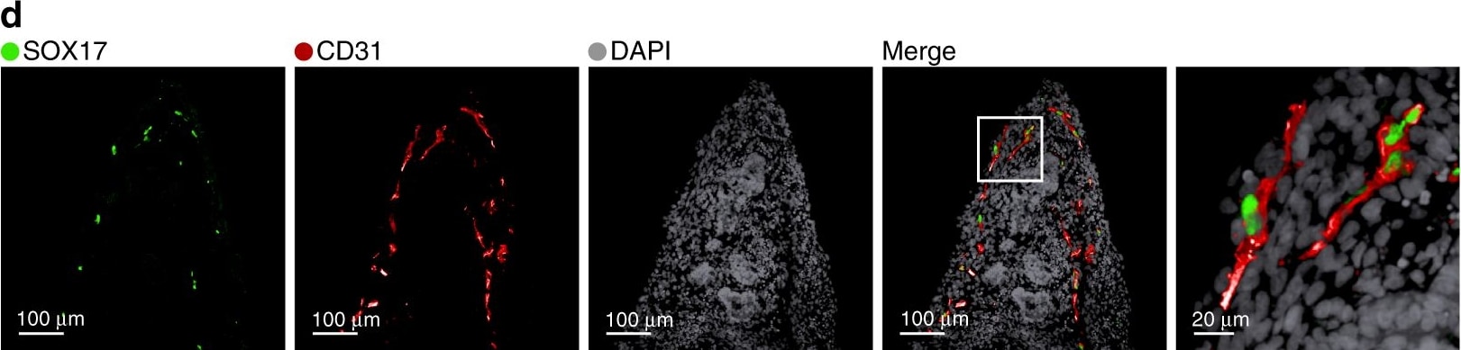 Detection of Human SOX17 by Immunocytochemistry/Immunofluorescence