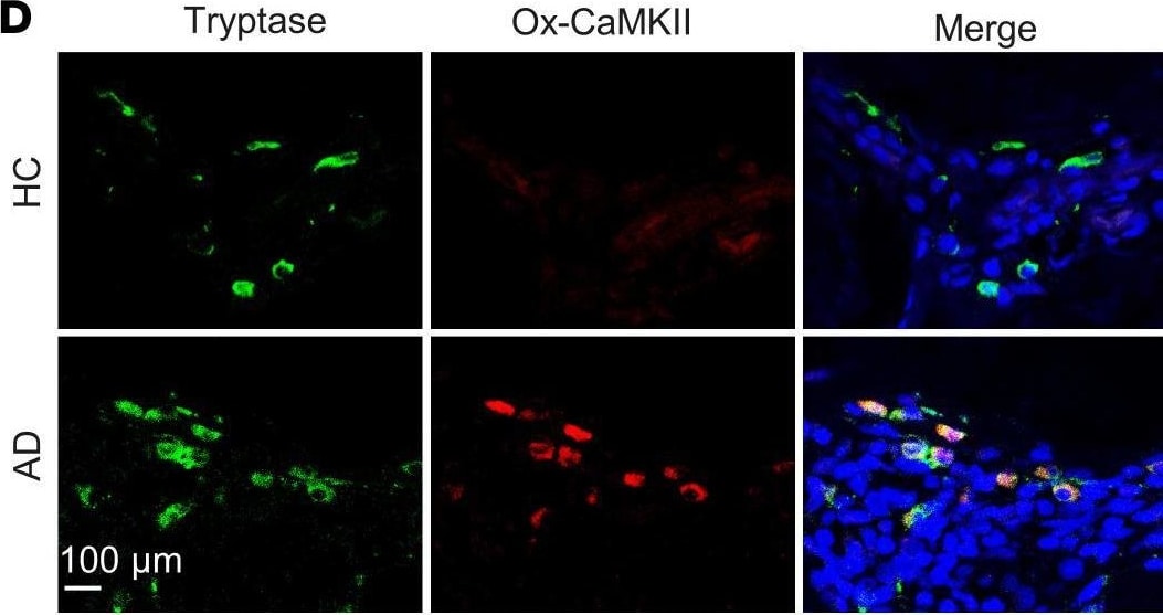 Detection of Tryptase beta-1/Mcpt7 by Immunohistochemistry