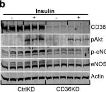 Detection of CD36/SR-B3 by Western Blot