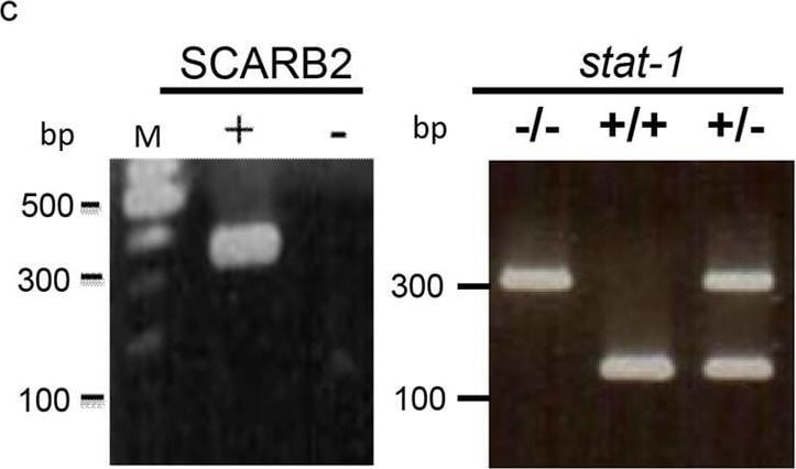 Detection of LIMPII/SR-B2 by Western Blot