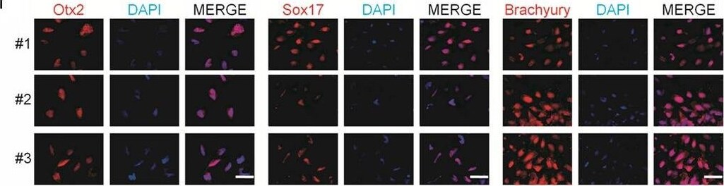 Detection of Human Otx2 by Immunocytochemistry/Immunofluorescence