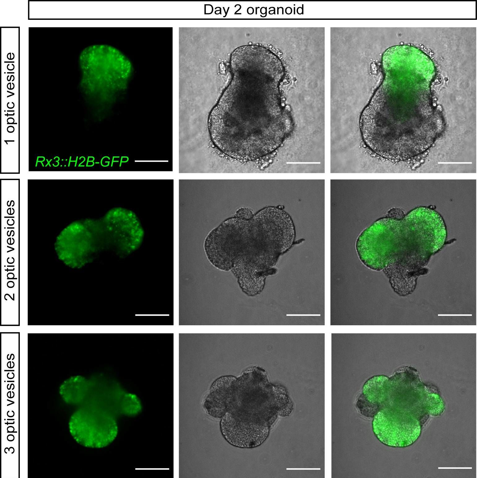 Detection of Zebrafish Otx2 by Immunohistochemistry