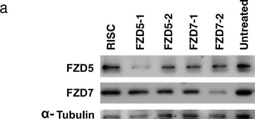 Detection of Frizzled-7 by Western Blot