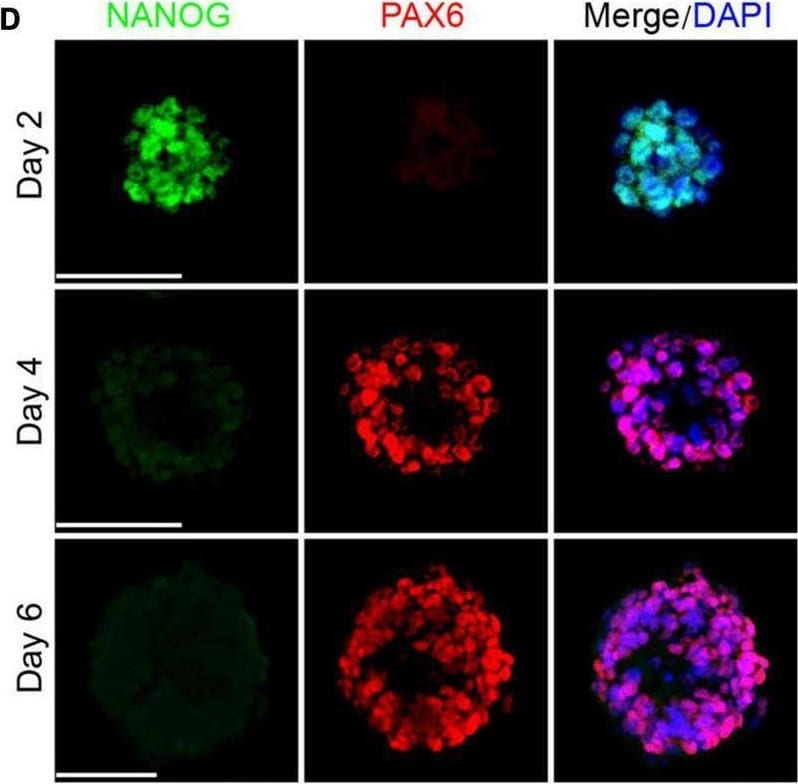 Detection of Nanog by Immunocytochemistry/ Immunofluorescence