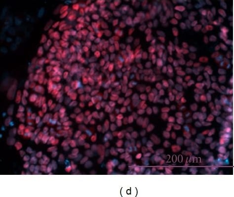 Detection of Human Nanog by Immunocytochemistry/Immunofluorescence