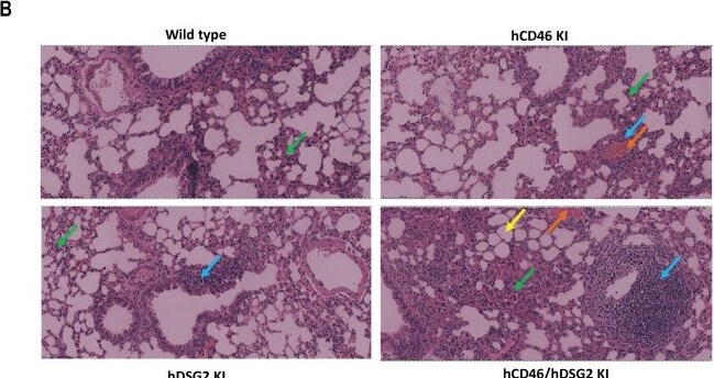 Detection of CD46 by Immunohistochemistry