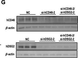 Detection of CD46 by Western Blot