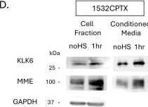 Detection of Kallikrein 6/Neurosin by Western Blot