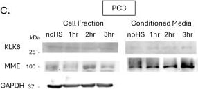 Detection of Kallikrein 6/Neurosin by Western Blot