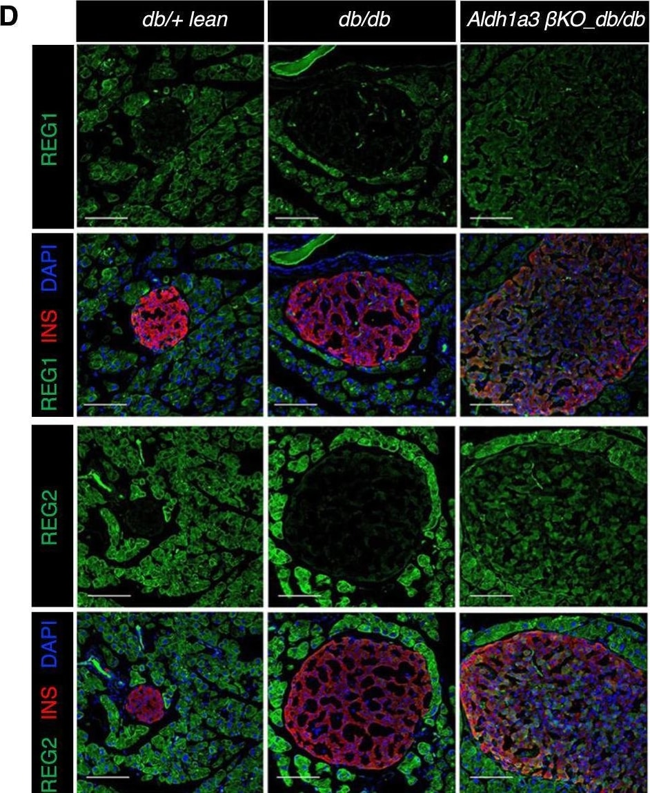 Detection of Reg2 by Immunohistochemistry