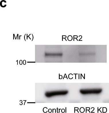 Detection of Human ROR2 by Western Blot