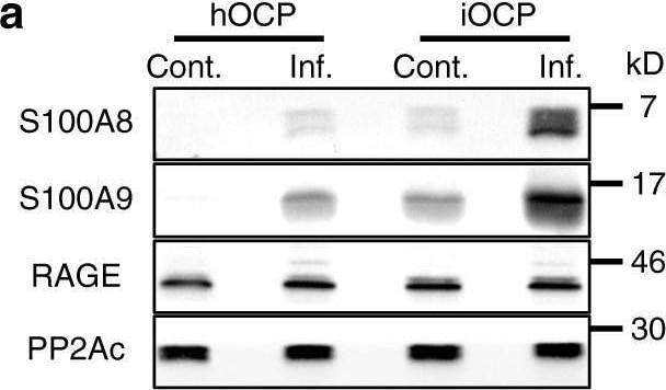 Detection of S100A9 by Western Blot