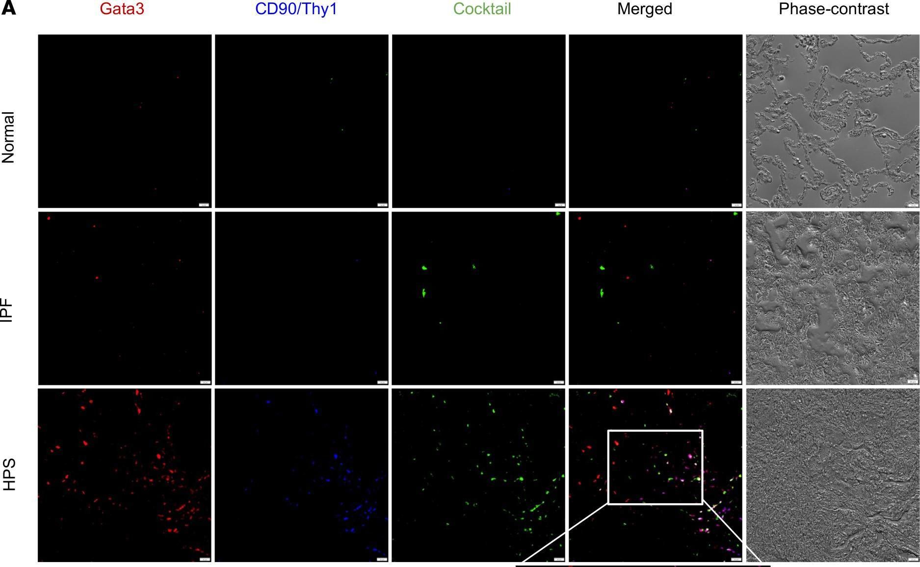 Detection of CD90/Thy1 by Immunocytochemistry/ Immunofluorescence