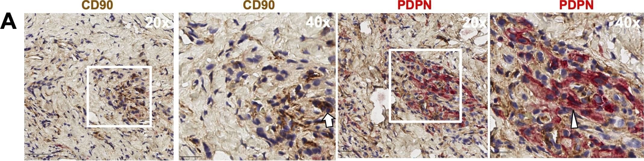 Detection of bshq0d8ep9smtgobgp8t.jpg by Immunohistochemistry