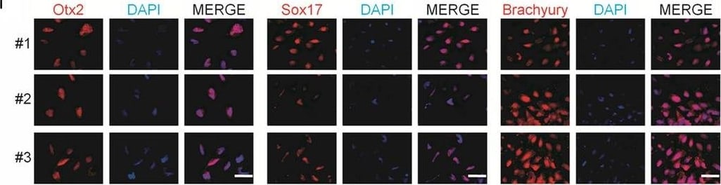 Detection of Human Brachyury by Immunocytochemistry/Immunofluorescence