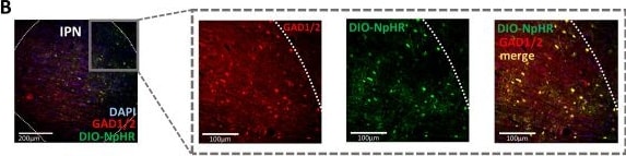 Detection of GAD1/GAD67 by Immunohistochemistry