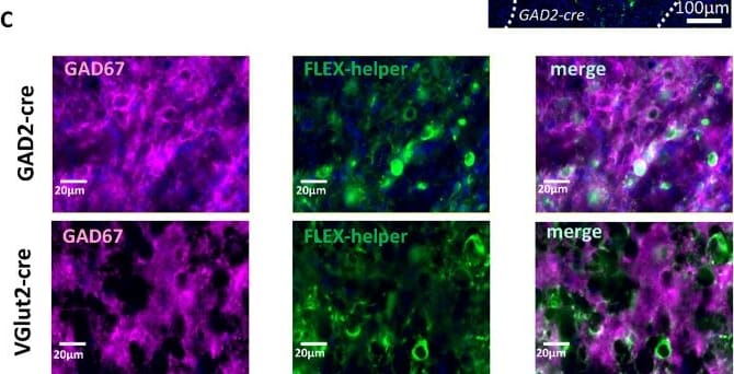 Detection of GAD1/GAD67 by Immunohistochemistry