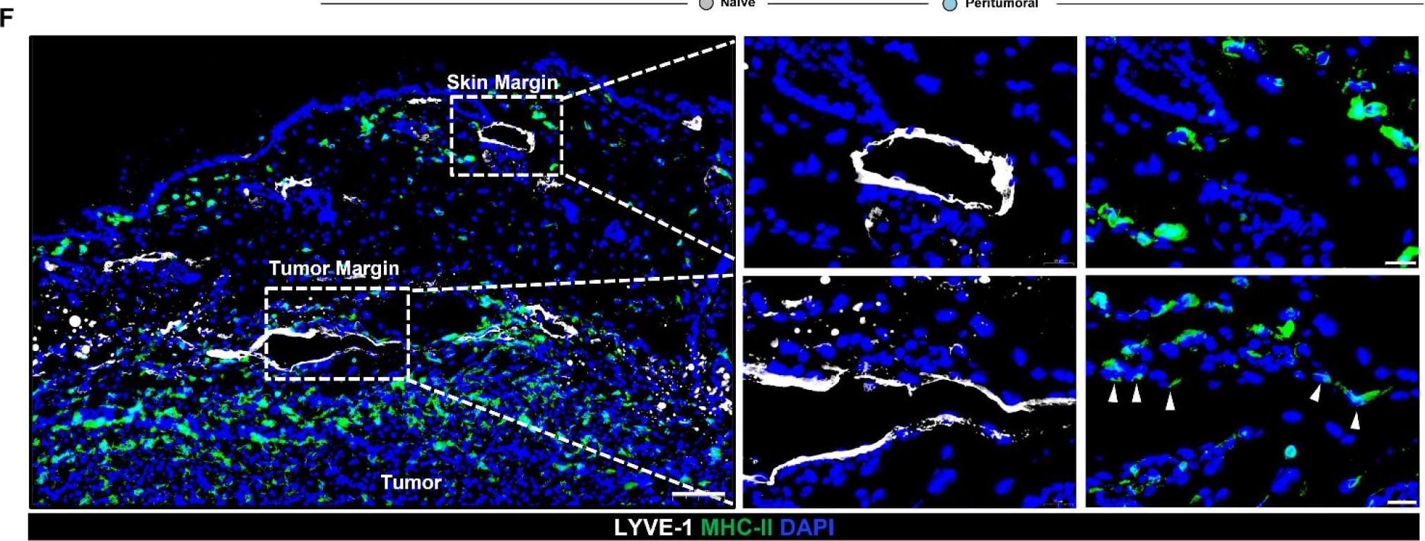 Detection of Mouse LYVE-1 by Immunohistochemistry