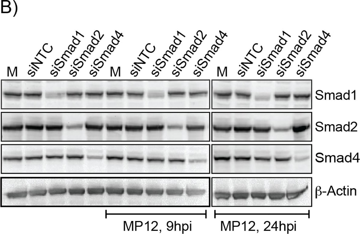 Detection of Human Smad4 by Western Blot