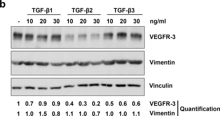 Detection of Human Vimentin by Western Blot