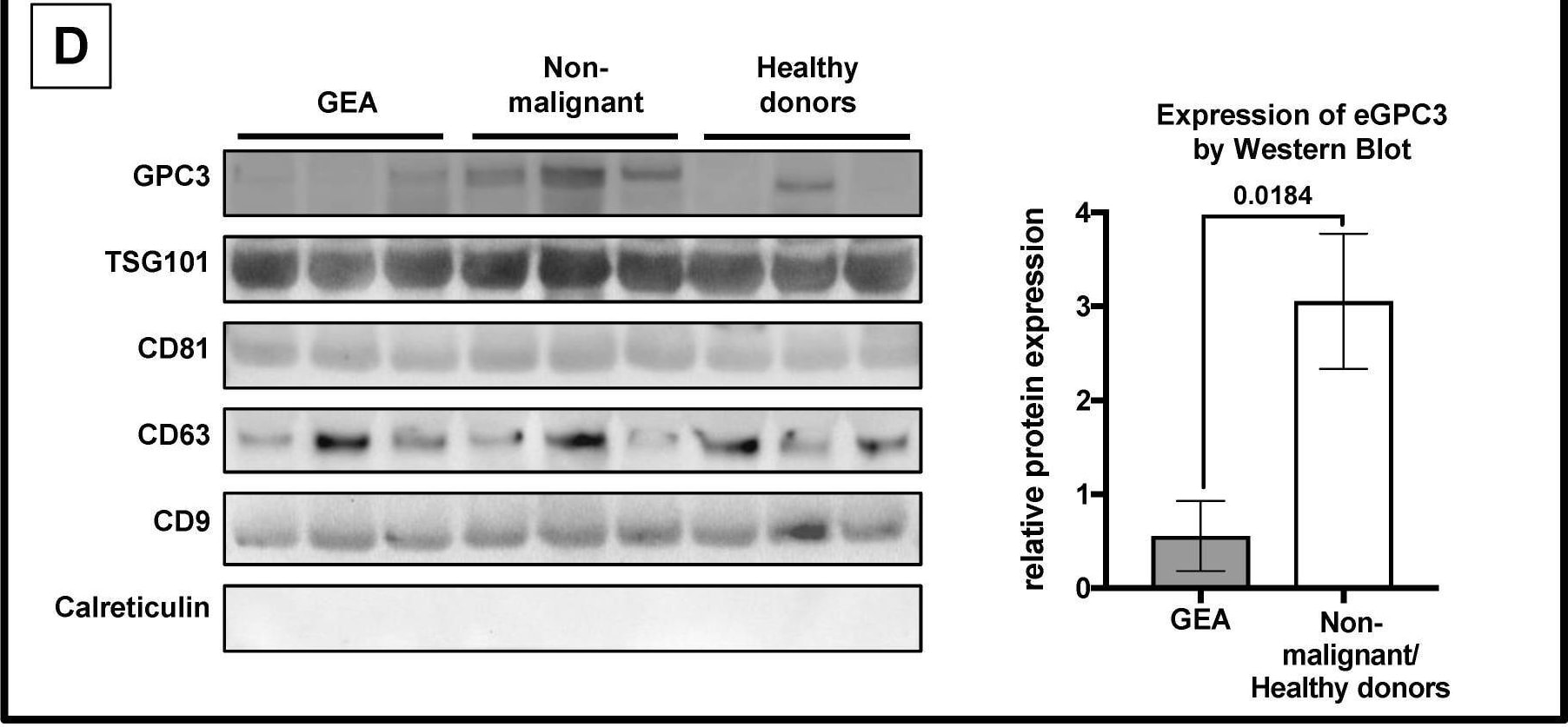 Detection of Glypican 3 by Western Blot