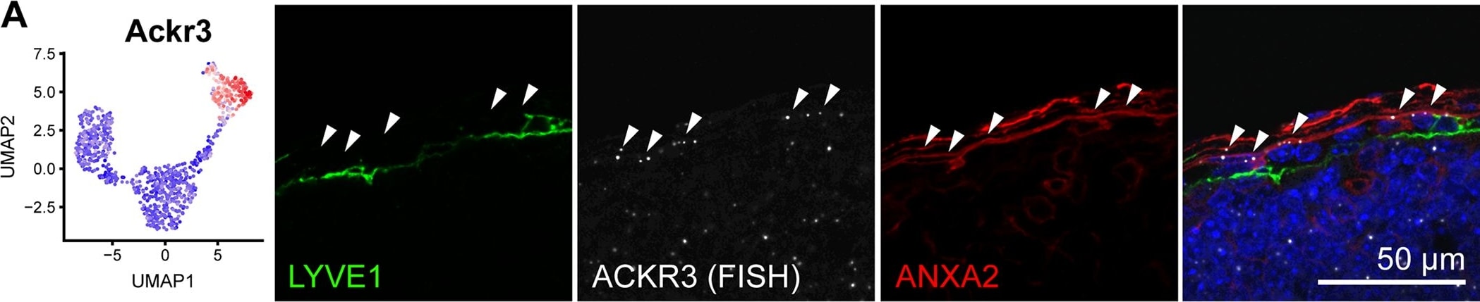 Detection of Mouse LYVE-1 by Immunocytochemistry/Immunofluorescence