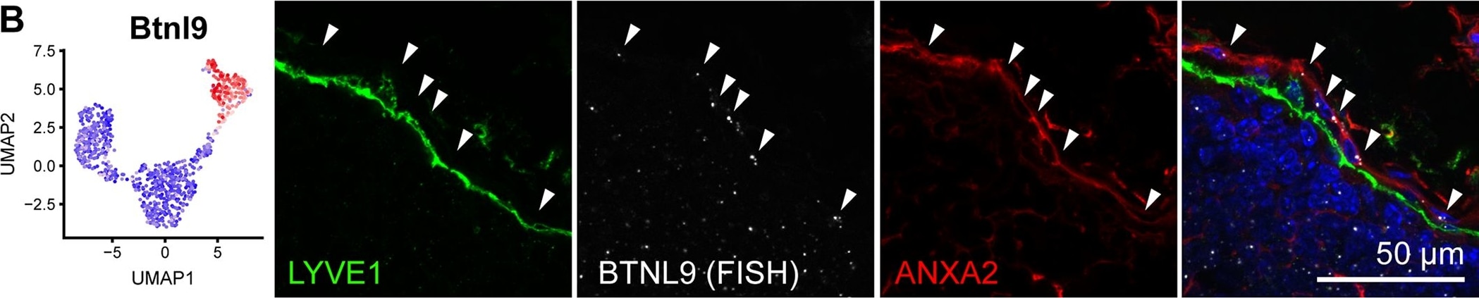 Detection of Mouse LYVE-1 by Immunocytochemistry/Immunofluorescence
