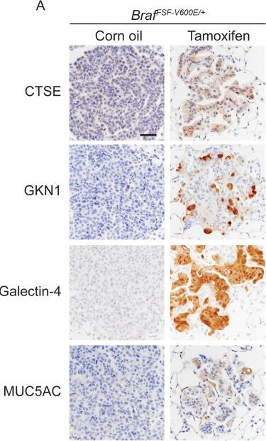 Detection of Galectin-4 by Immunohistochemistry