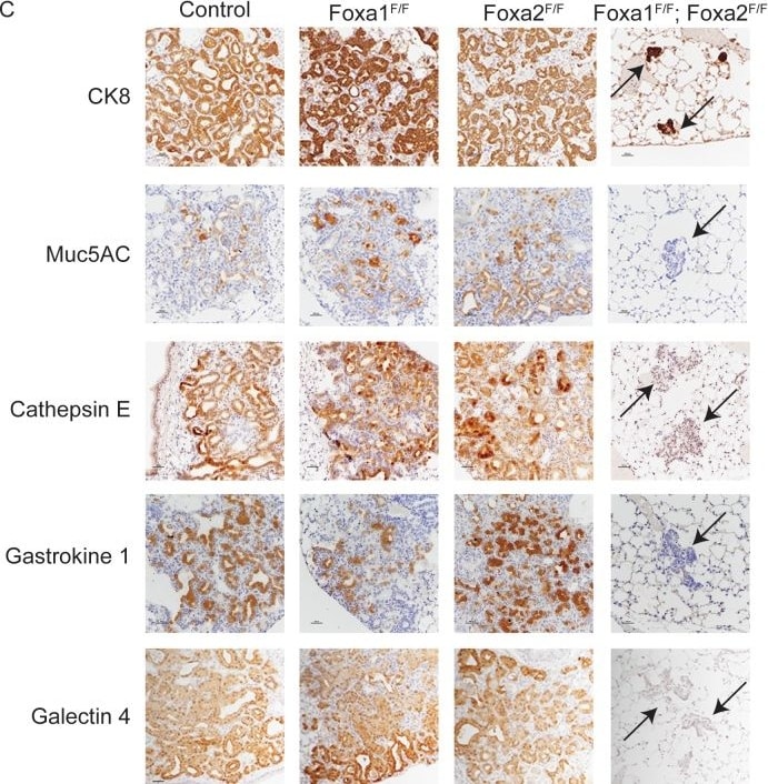 Detection of Galectin-4 by Immunohistochemistry