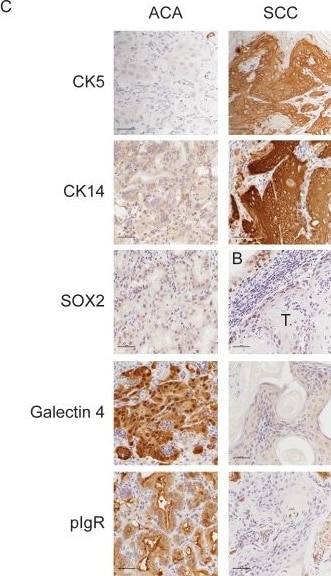 Detection of Galectin-4 by Immunohistochemistry