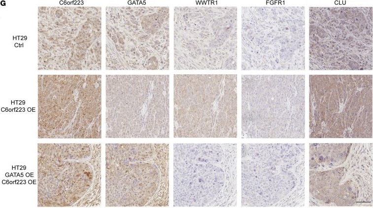 Detection of GATA-5 by Immunohistochemistry