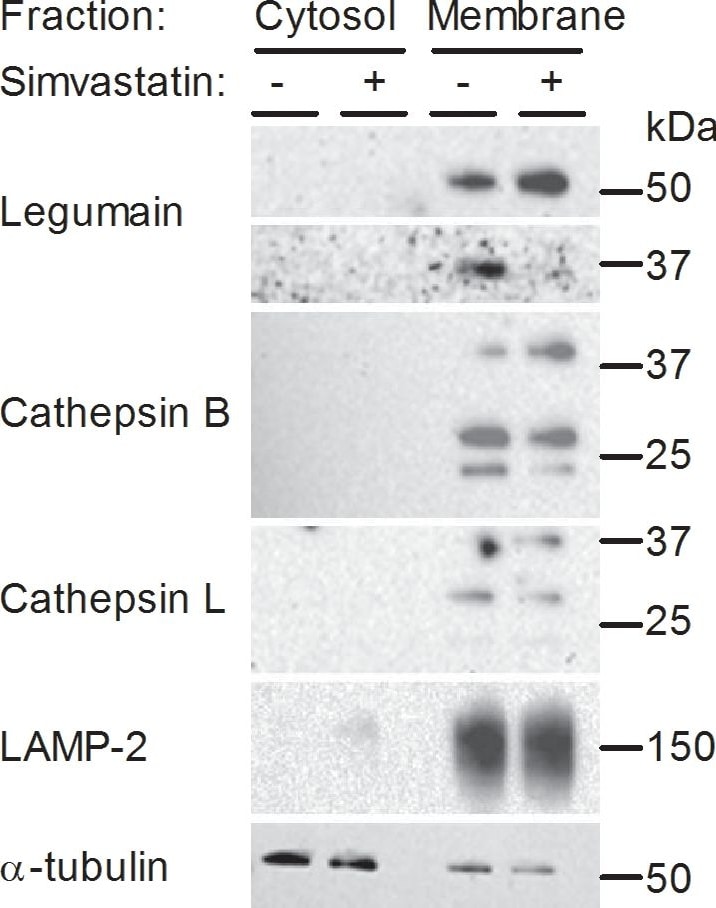 Detection of Human Legumain/Asparaginyl Endopeptidase by Western Blot