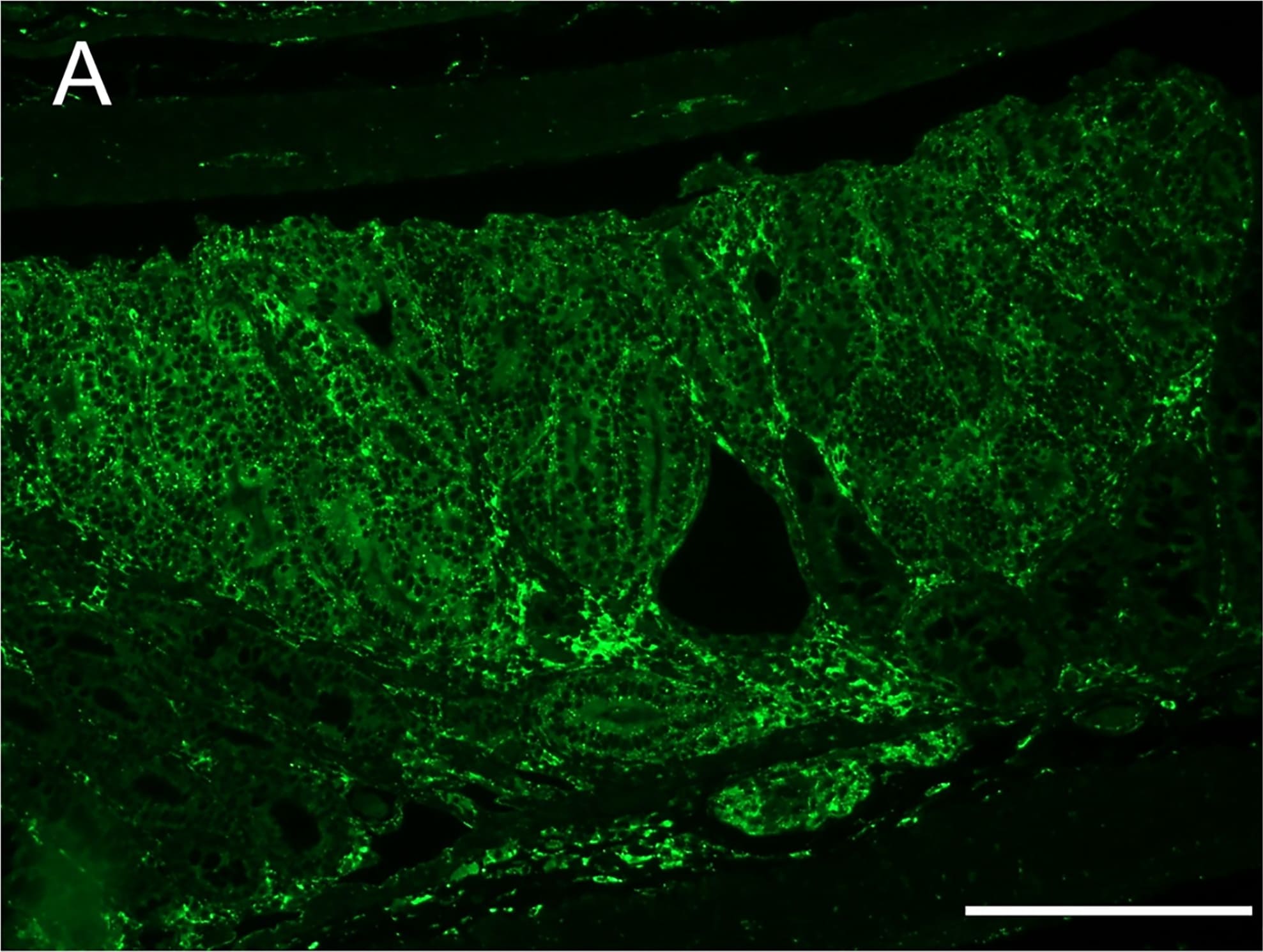 Detection of Mouse Legumain/Asparaginyl Endopeptidase by Immunocytochemistry/Immunofluorescence