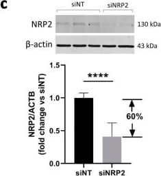 Detection of Neuropilin-2 by Western Blot