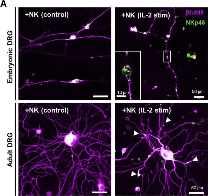Detection of Mouse NKp46/NCR1 by Immunocytochemistry/Immunofluorescence