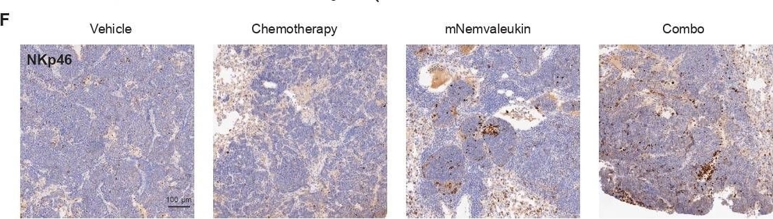 Detection of NKp46/NCR1 by Immunohistochemistry